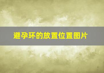 避孕环的放置位置图片