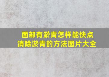 面部有淤青怎样能快点消除淤青的方法图片大全